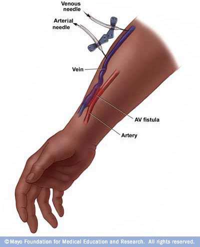artery vein capillary. By doing this the capillaries
